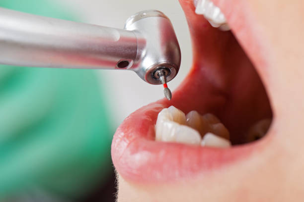 Best Walk-In Emergency Dental Services in Port St John, FL